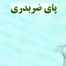 دانلود پاورپوینت پای ضربدری