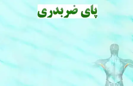 دانلود پاورپوینت پای ضربدری